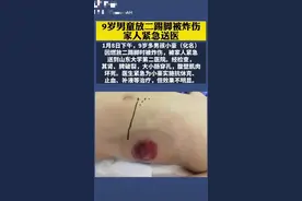 济南9岁男孩被“二踢脚”炸伤，目前仍未脱离危险图片