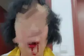 六旬阿婆被退管所人员打伤续：获赔6万，打人者母亲代为道歉图片