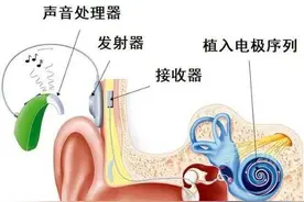 青大附院人工听觉植入及听力障碍专病门诊正式开诊图片