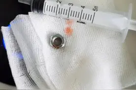 5岁孩子不停流涕甚至鼻出血，罪魁祸首竟是它！图片