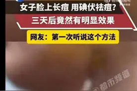 涂抹碘伏祛痘3天就见效？惊呆女大学生！皮肤科专家：可以但没必要图片