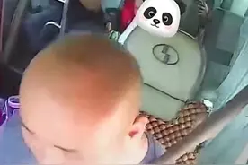 男子没系安全带，路面颠簸被弹起六次致骨折！盘点那些骨折案例图片