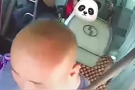 男子没系安全带，路面颠簸被弹起六次致骨折！盘点那些骨折案例图片