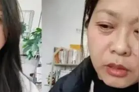 42岁女子经历20天“断崖式衰老”，是因为它图片