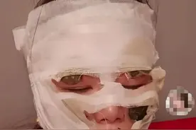 婚礼当天新娘险被毁容！这种东西要慎用图片