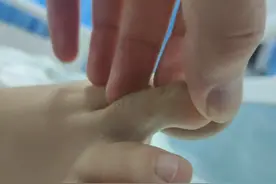 三亚女游客被不明物咬伤身亡，亲属称已与医院会谈！病历封存图片