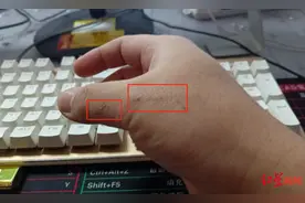 民警抓捕嫌疑人时手被抓伤，嫌疑人被证实患艾滋病 受伤民警已接受阻断治疗图片