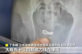 15岁男孩腹痛尿频，医生从下体拿出一串……差点毁了一生！图片