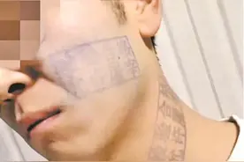 小伙猪肉印章盖脸上，时隔五天终于洗掉，称：不要模仿图片