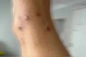 剧毒！已入侵12省份，严重可致命！图片