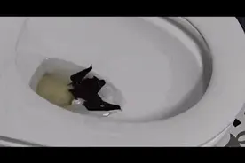 河南女子徒手抓蝙蝠被咬伤，整个手部肿胀需打12针！专家：蝙蝠是狂犬病病毒的“高危传播宿主”图片