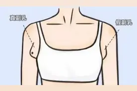 美容院里消除副乳？实话说，不靠谱！图片