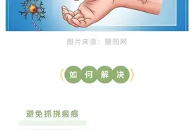 夏季瘢痕瘙痒难忍？教你几招缓解方法图片