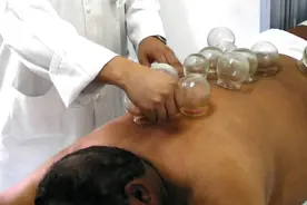 每天上午就约满！亚运村拔火罐受追捧，外国运动员体验“神秘的东方力量”图片