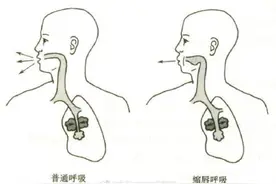 呼吸康复训练——缩唇呼吸图片