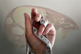 吃素减肥，怎么反而会得脂肪肝？图片