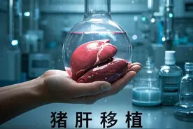 鱼眼·观察丨器官移植里程碑！猪肝移给植物人效果如何？华大基因生……图片