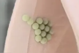 密密麻麻！千万别碰！很多人家中突然大量出现……图片
