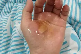 “身体都是硬的”！女子洗澡险丢命，赶紧自查图片