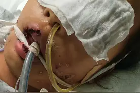 小学女生赛跑中晕倒20多天后离世 郑州郑东新区教体局：正在协商处理图片