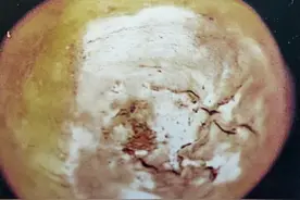 【农业知识】马铃薯干腐病的防治图片