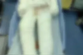 19岁烧伤女孩百万救命款一天捐齐，哥哥泣不成声感谢陌生人大爱图片