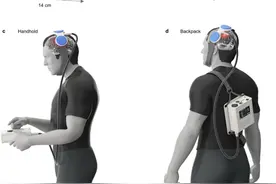 中科院自动化所研发出可穿戴经颅磁刺激设备图片