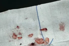 警惕！干冰处置不当，可能会引发严重后果图片