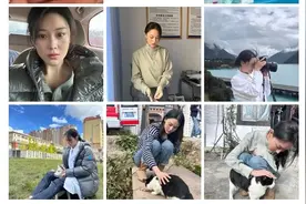 【健康】急！头发突然秃了一块！好尴尬，怎么办？图片