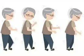 走路姿势异常可能是种病丨健康智慧屋图片