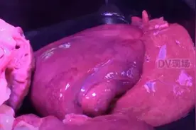 一家五口感染！祸首竟是这道家常菜图片