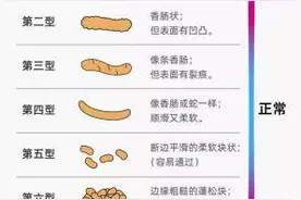 从“难解之忧”到“畅通之喜”！山东省立第三医院肠道菌群移植为帕金森病便秘患者带来新希望图片