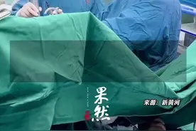 云南一医院医生手术中玩梗引争议，院方回应：为缓解医务人员工作压力图片