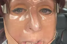 英国女子为救狗跑进火场后严重烧伤，现在想代表英国队参加残奥会图片