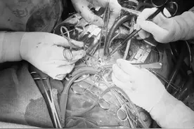 淄博世博高新医院病例分享——主动脉瓣重度狭窄患者的治疗历程图片