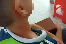 友话直说丨“未戴红领巾被校长撸脖子”，照见惩戒观念的城乡差距图片