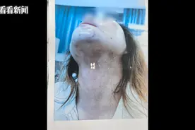 打断肋骨、划伤胸部……男子屡次家暴妻子，被刑事立案！图片