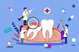 智齿都要拔？拔智齿能小v脸？图片