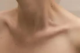 这几个地方长“痣”一定要当心！图片