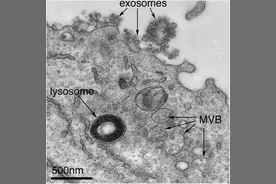 富豪追捧的抗衰黑科技“外泌体”，到底是个啥？图片