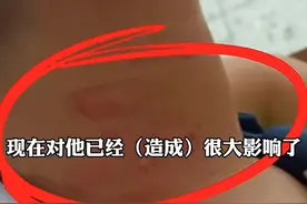 男孩未戴红领巾被校长掐脖，这不是体罚而是滥施暴力|新京报快评图片