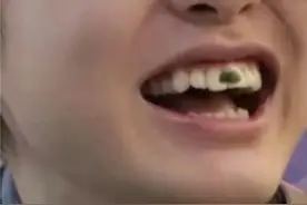 牙齿上的一种东西，只能通过刷牙去除！图片
