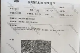 赤峰一男子阑尾炎手术15个月后在体内发现纱布，当地医调委已介入图片