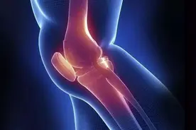 膝关节疼痛常见原因，您属于哪一种？丨贤医健康说图片