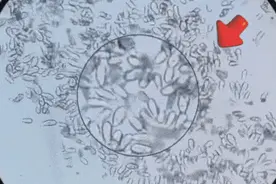 讲真，千万不要乱涂碘伏！千万不要！图片