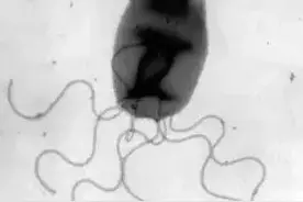 20岁小伙反复高烧40℃、几近失明！只因接触了这种动物……图片