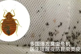 健康关注｜多国爆发臭虫危机 医生提醒提防昆虫类皮肤病图片