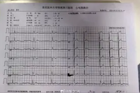 男子吃油炸蟾蜍后中毒 专家提醒：这些“夺命野味”别贪嘴图片