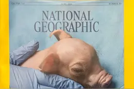 异种移植或为器官短缺带来新希望图片