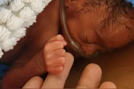 非常湘遇丨在中国医生的救治下，非洲“巴掌宝宝”终于出院了图片